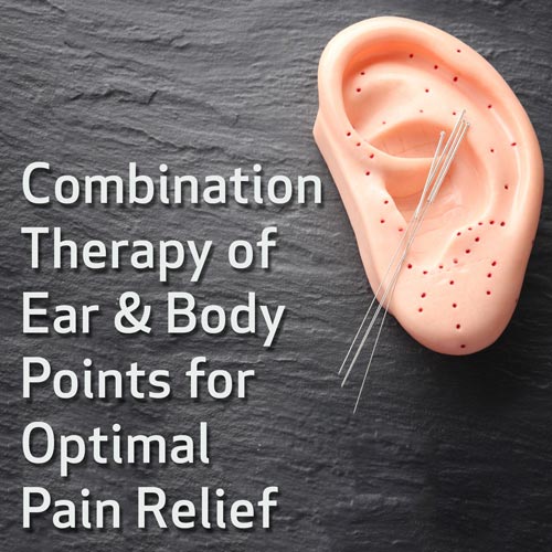 Combination Therapy of Ear and Body Points for Optimal Pain Relief
