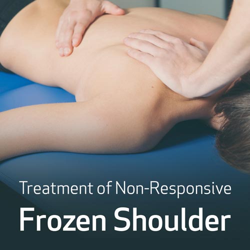 Treatment of Non-Responsive Frozen Shoulder